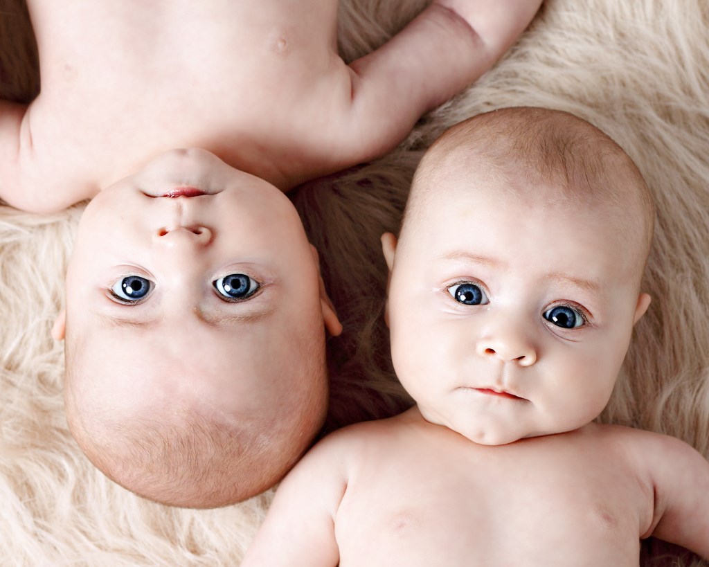 У світі народжується більше близнюків, ніж будь-коли раніше